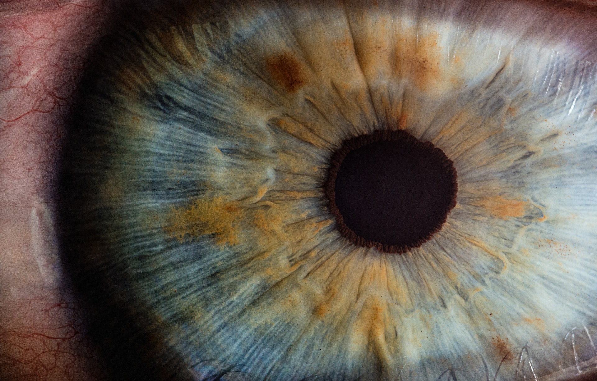 diabetic eye disease treatment